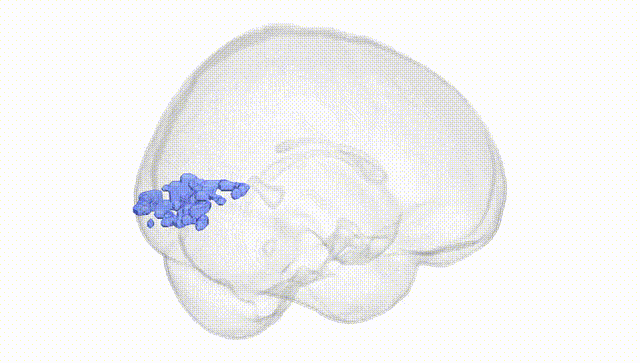 Full Brain White