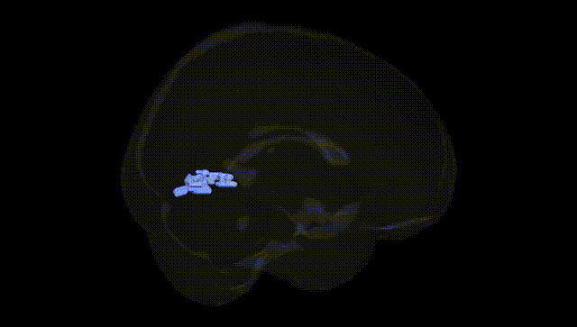 Full Brain Black