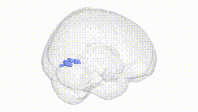 Full Brain White