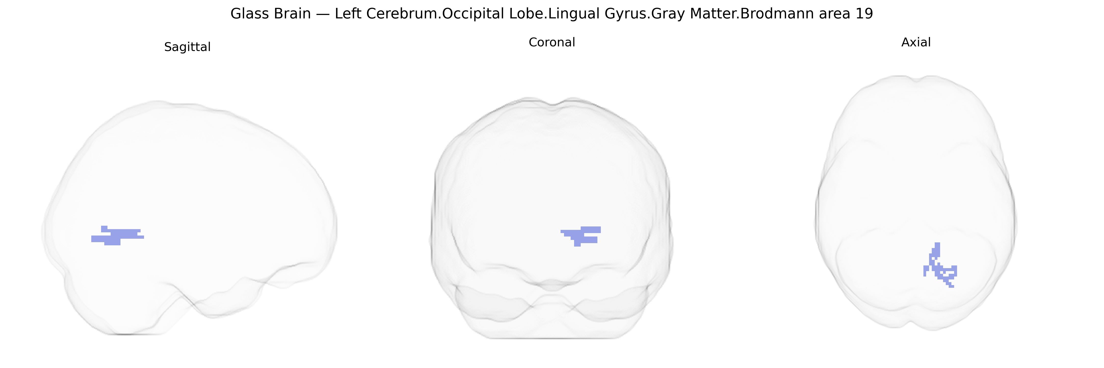 Triplanar Ghost Brain