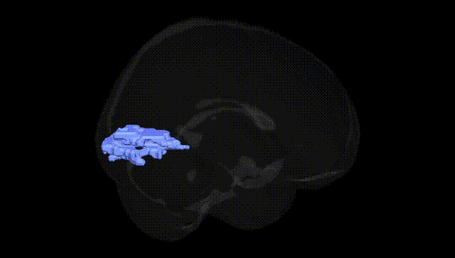 Full Brain Black