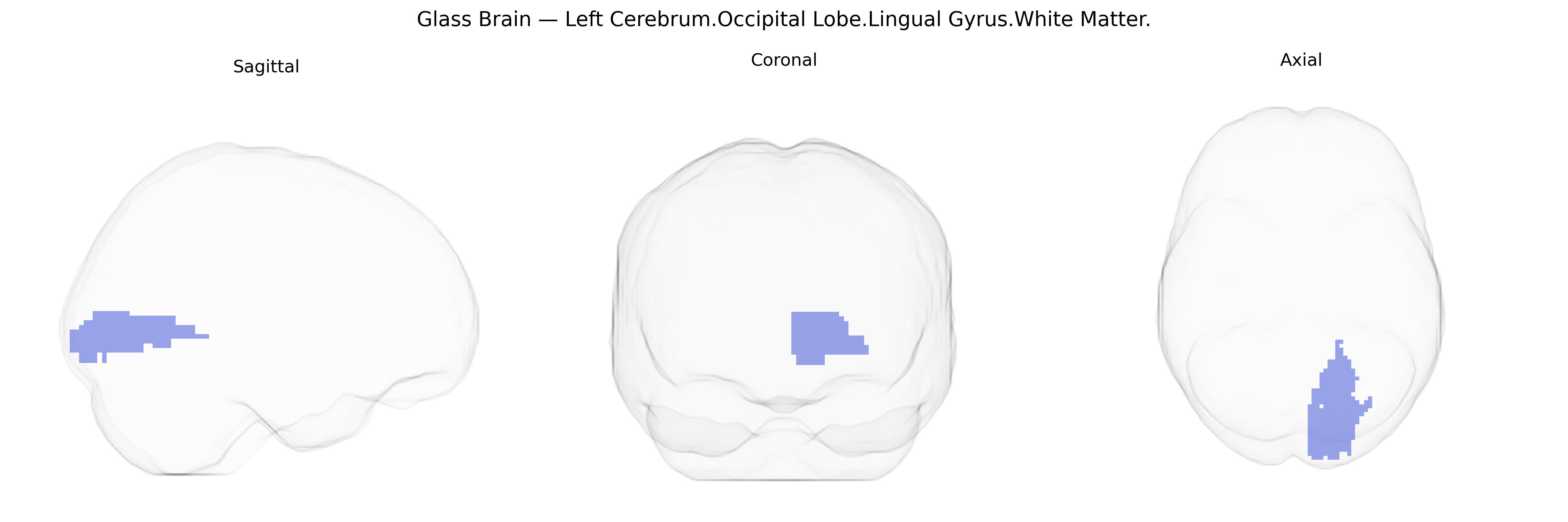 Triplanar Ghost Brain