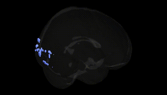Full Brain Black