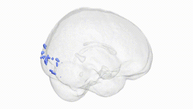 Full Brain White