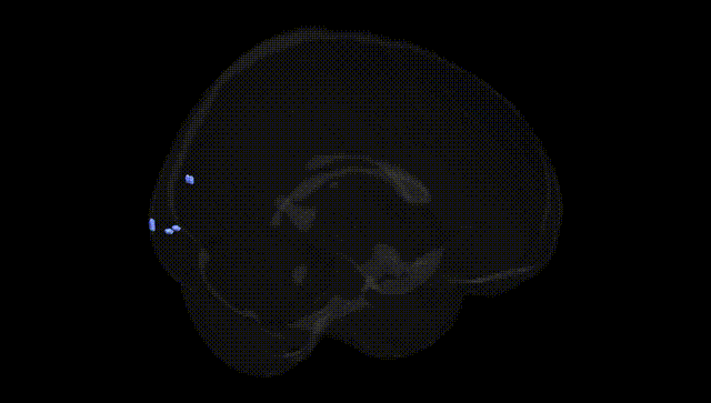 Full Brain Black
