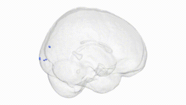 Full Brain White
