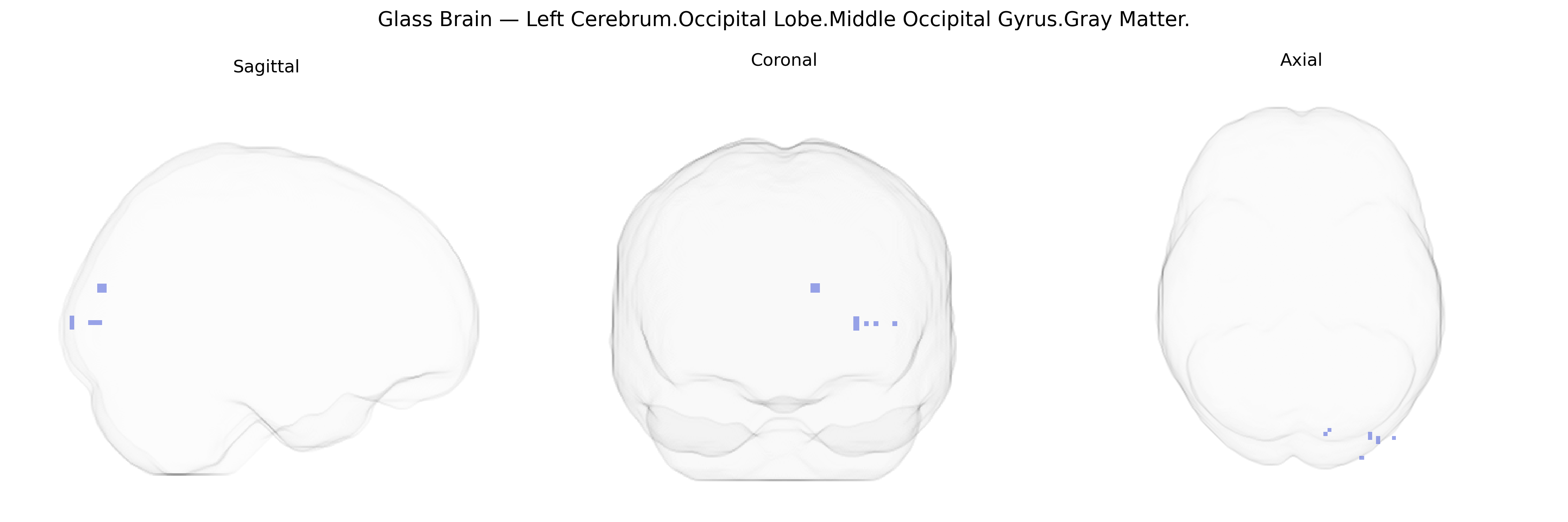 Triplanar Ghost Brain