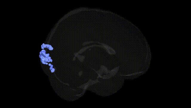 Full Brain Black