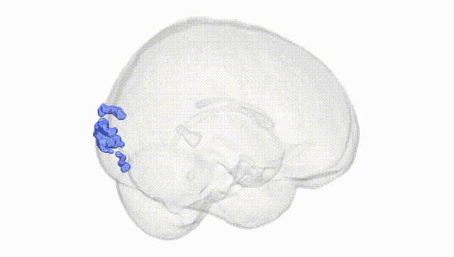 Full Brain White