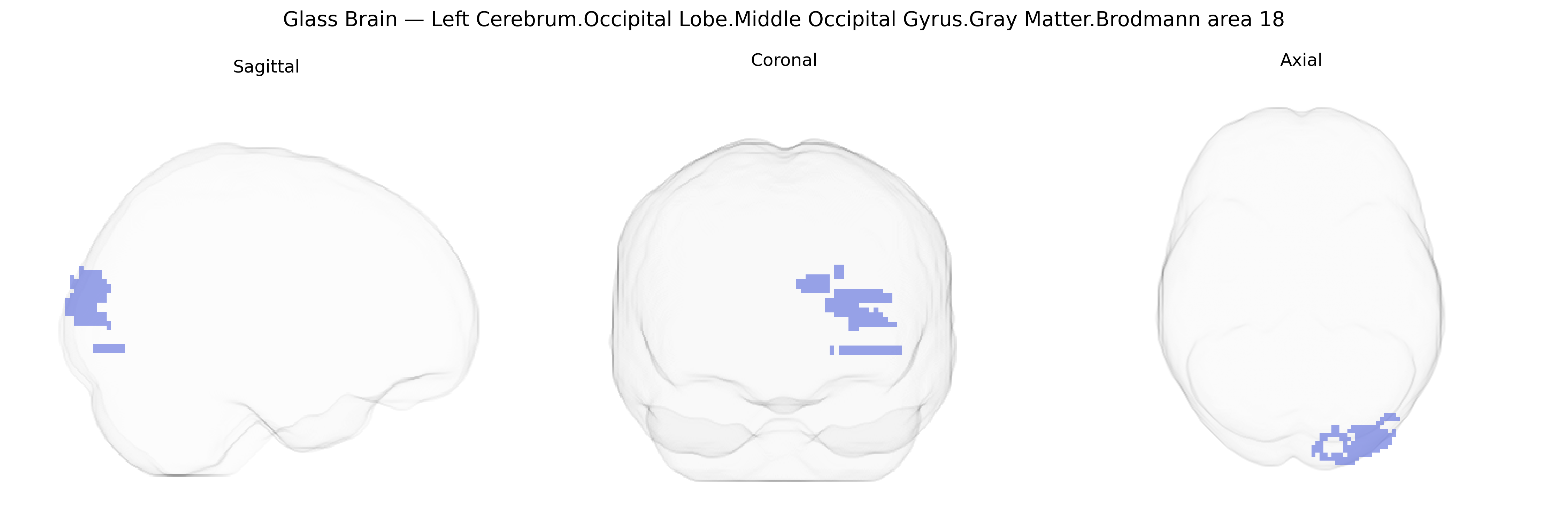 Triplanar Ghost Brain