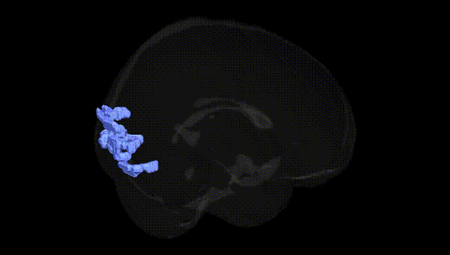 Full Brain Black