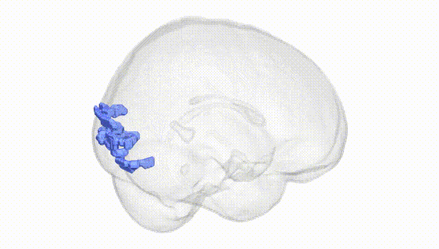 Full Brain White