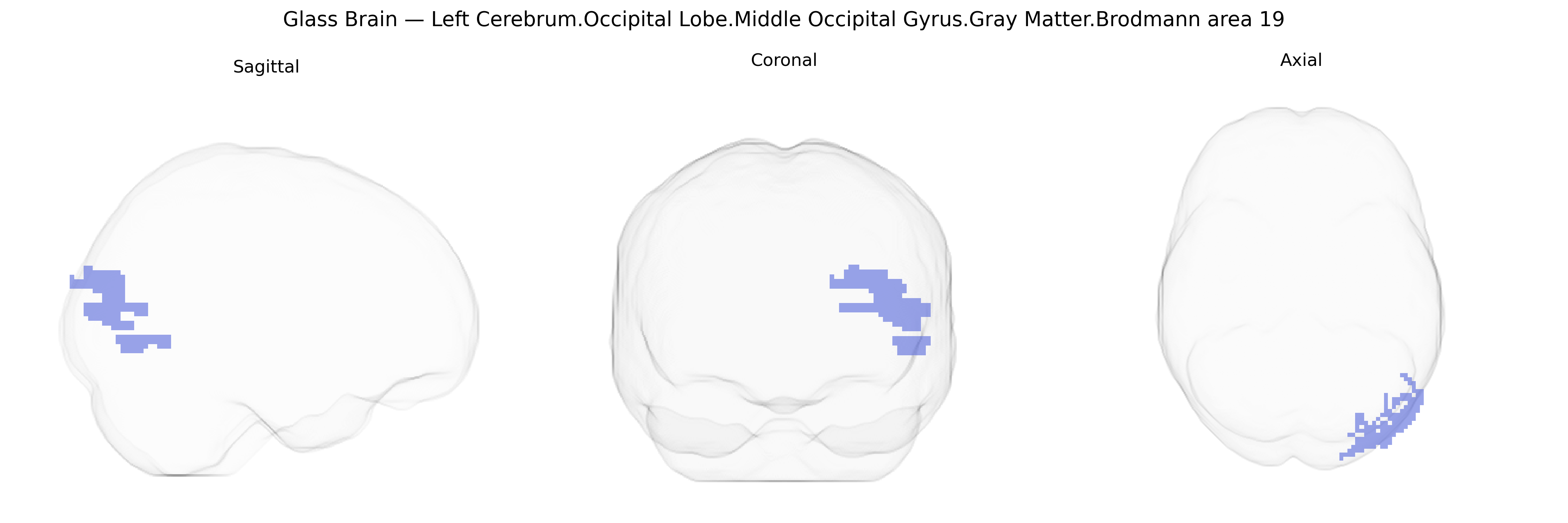 Triplanar Ghost Brain