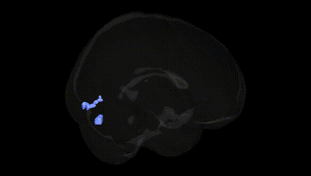 Full Brain Black