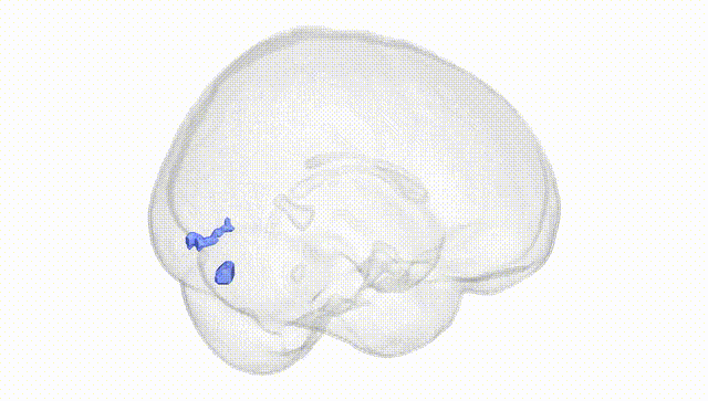 Full Brain White