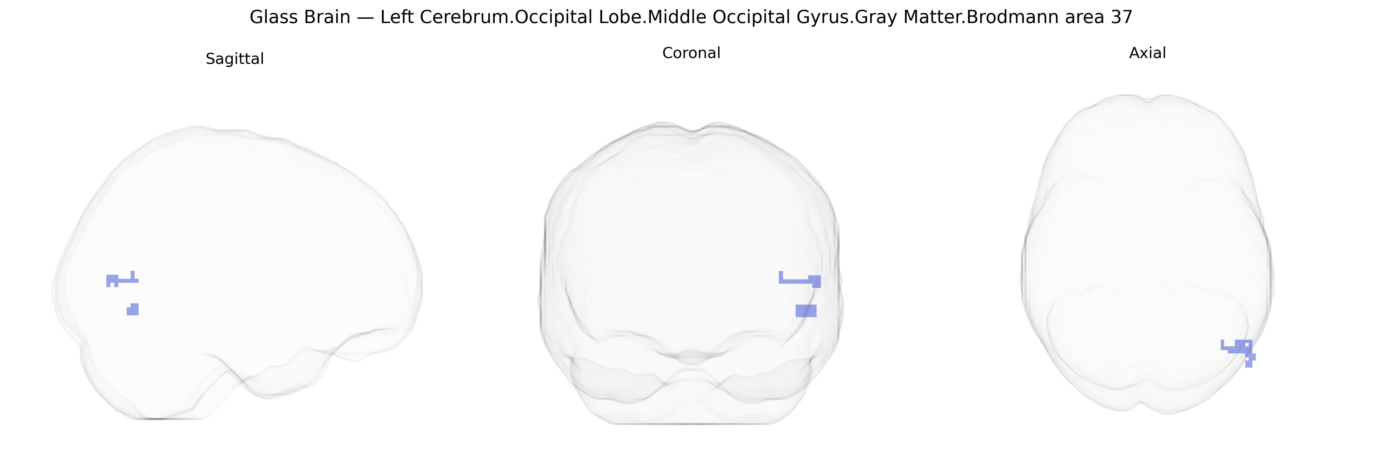 Triplanar Ghost Brain