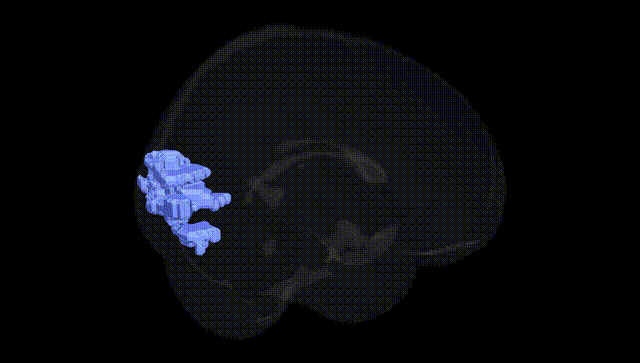 Full Brain Black
