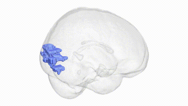 Full Brain White