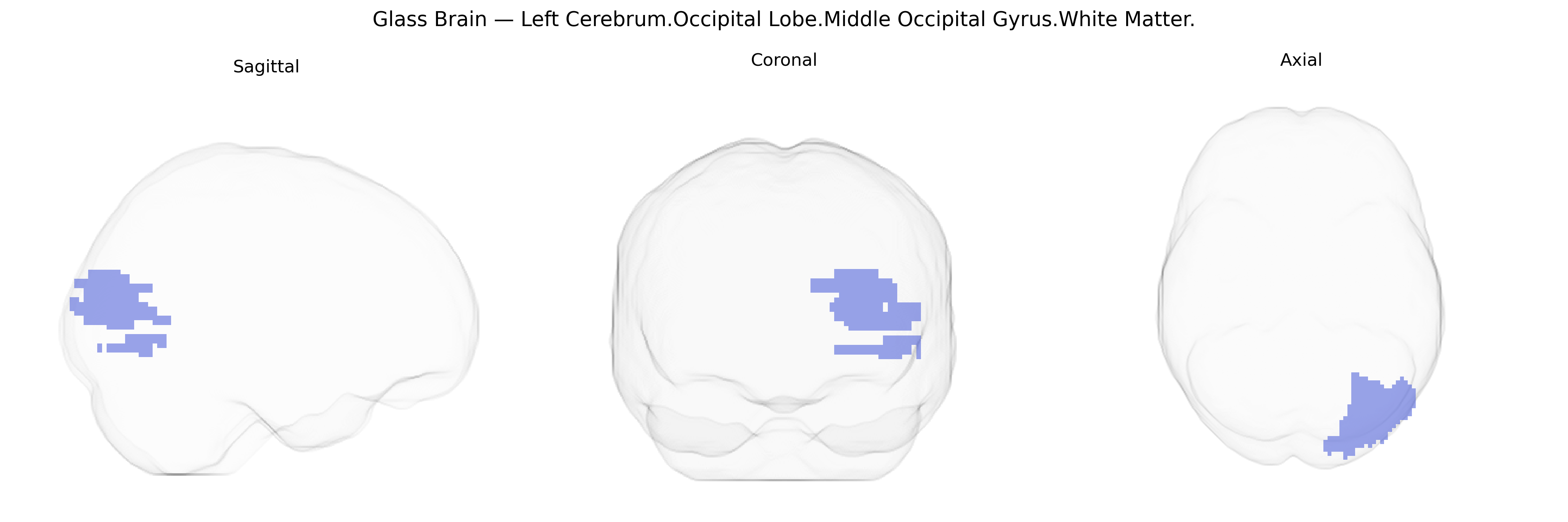 Triplanar Ghost Brain