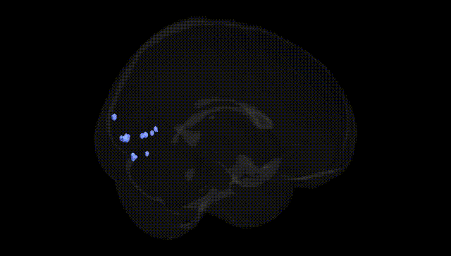 Full Brain Black