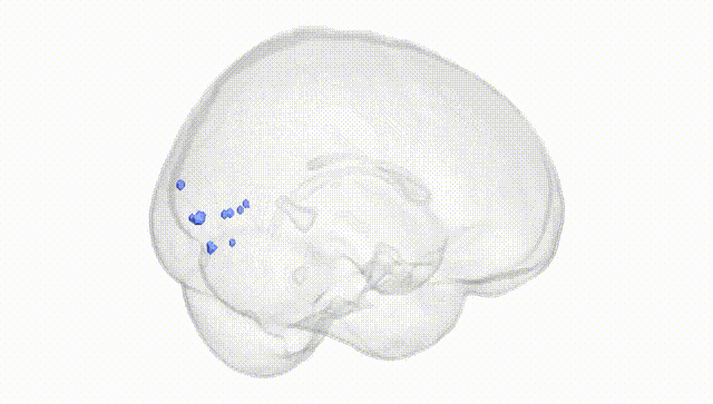 Full Brain White
