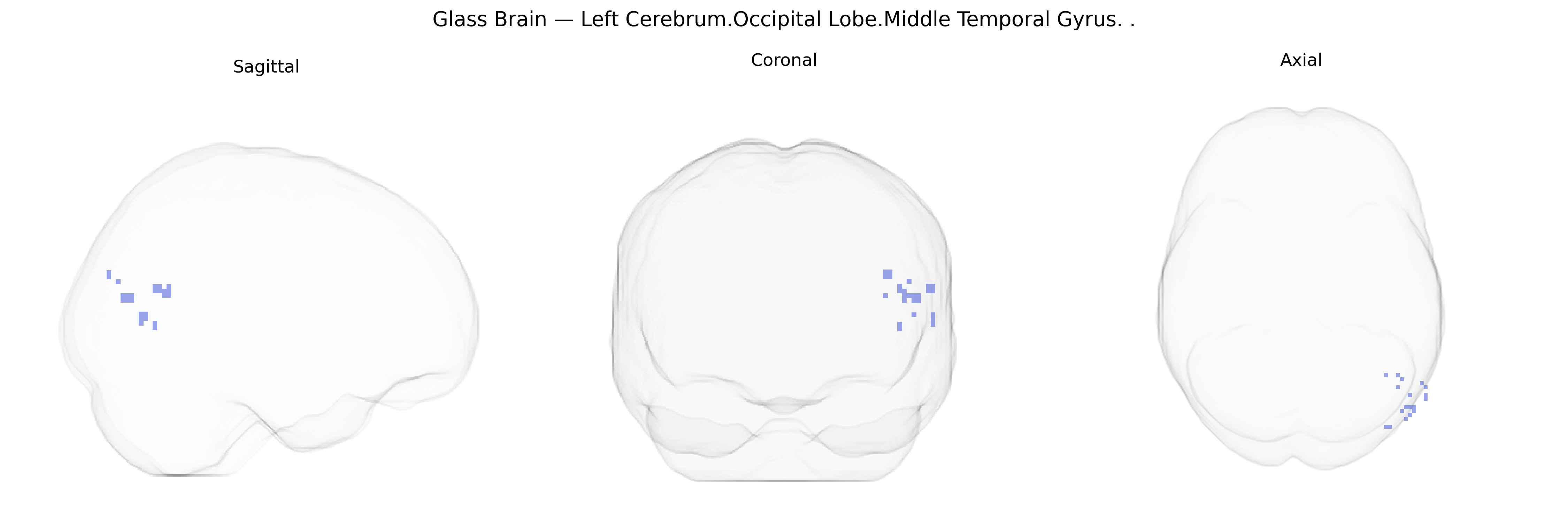 Triplanar Ghost Brain