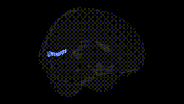 Full Brain Black