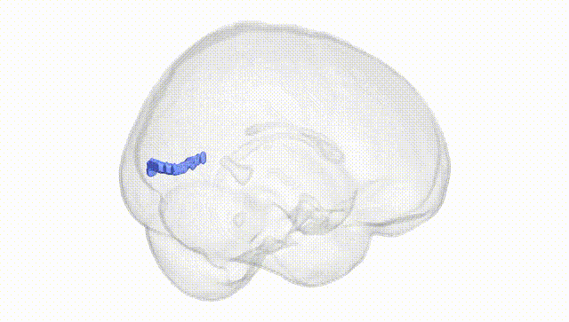 Full Brain White