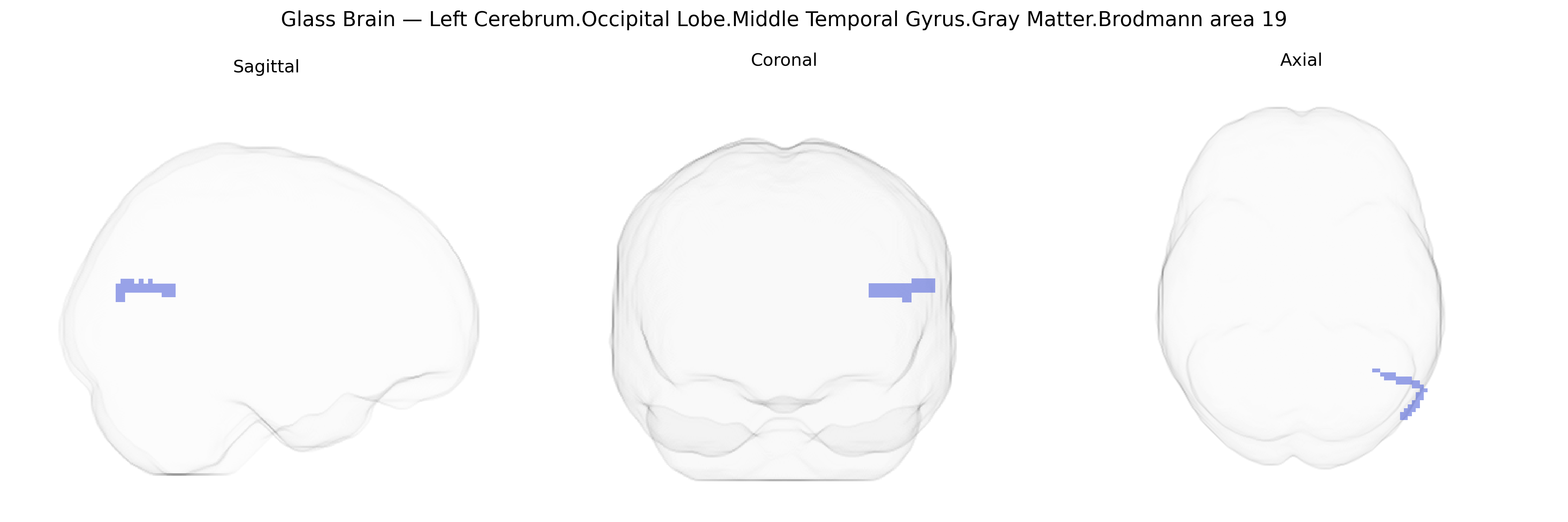 Triplanar Ghost Brain