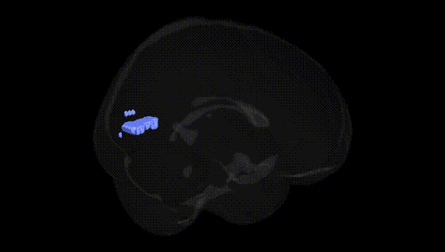Full Brain Black