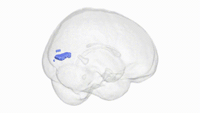 Full Brain White