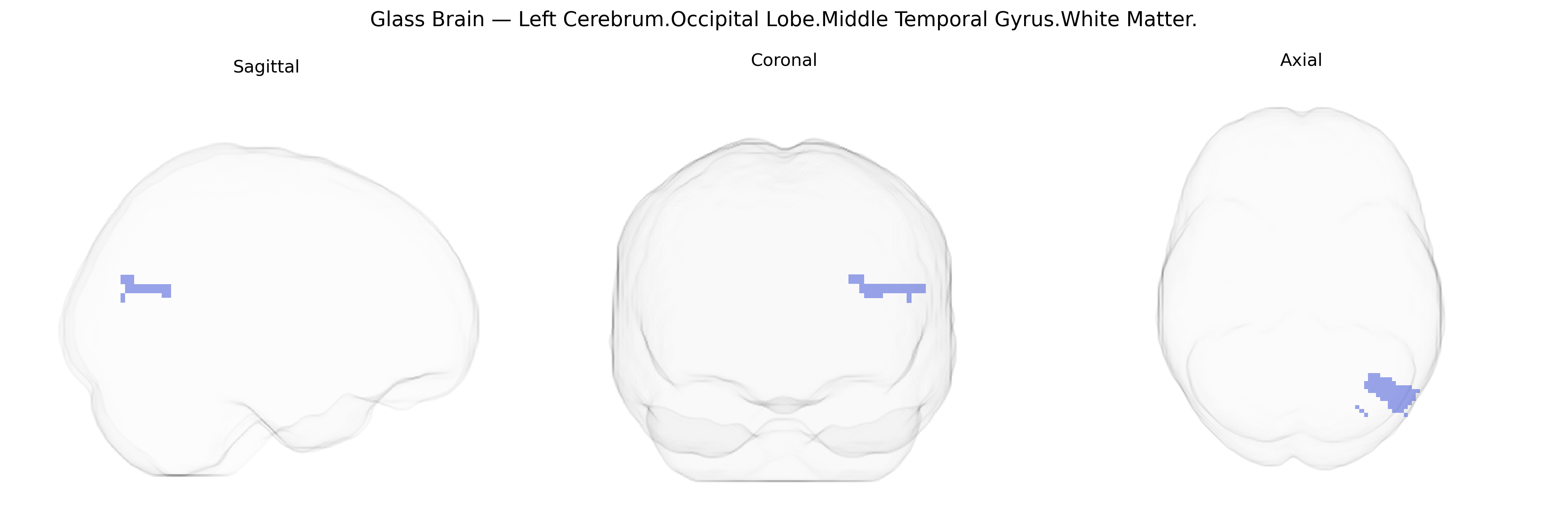 Triplanar Ghost Brain