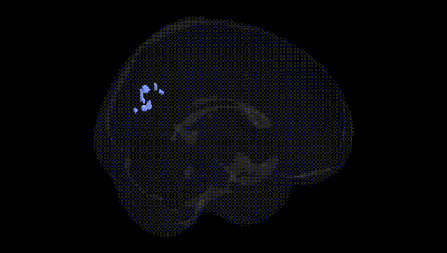 Full Brain Black