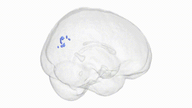 Full Brain White