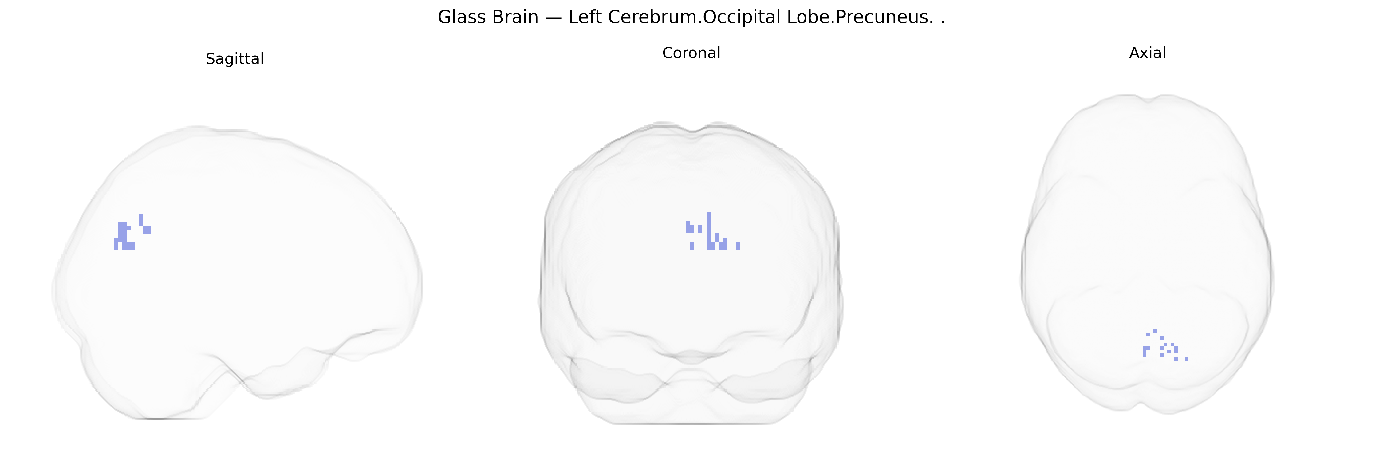 Triplanar Ghost Brain