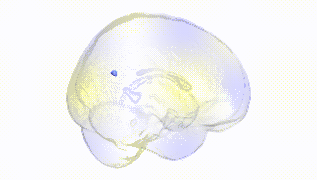 Full Brain White