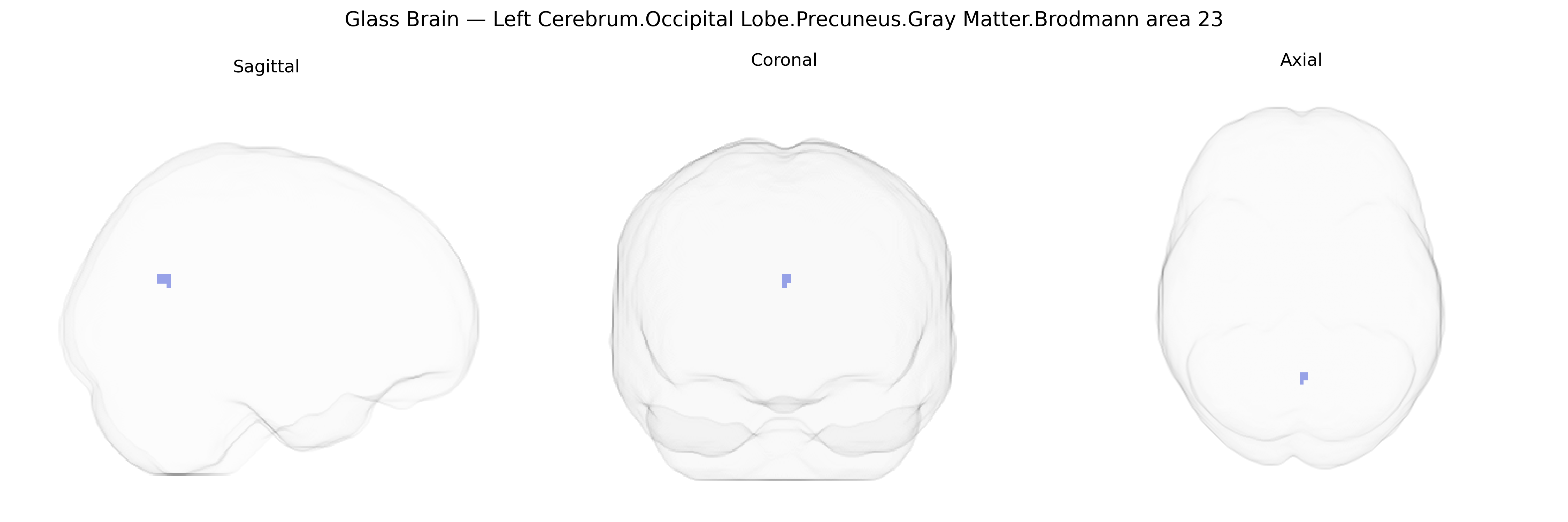 Triplanar Ghost Brain