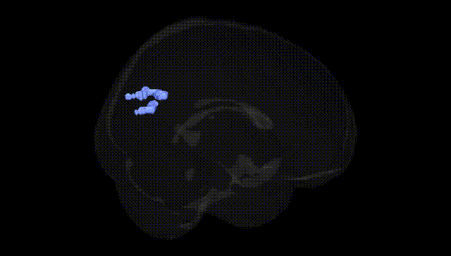 Full Brain Black