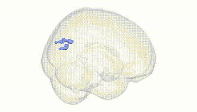 Full Brain White