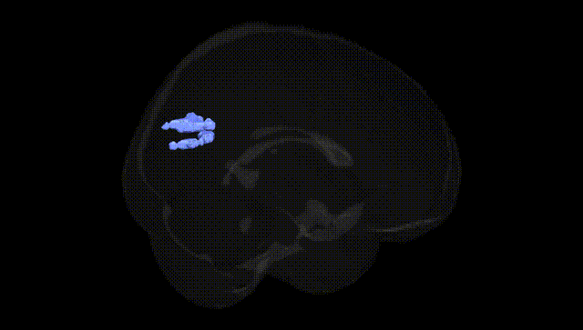 Full Brain Black