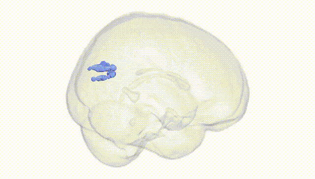 Full Brain White