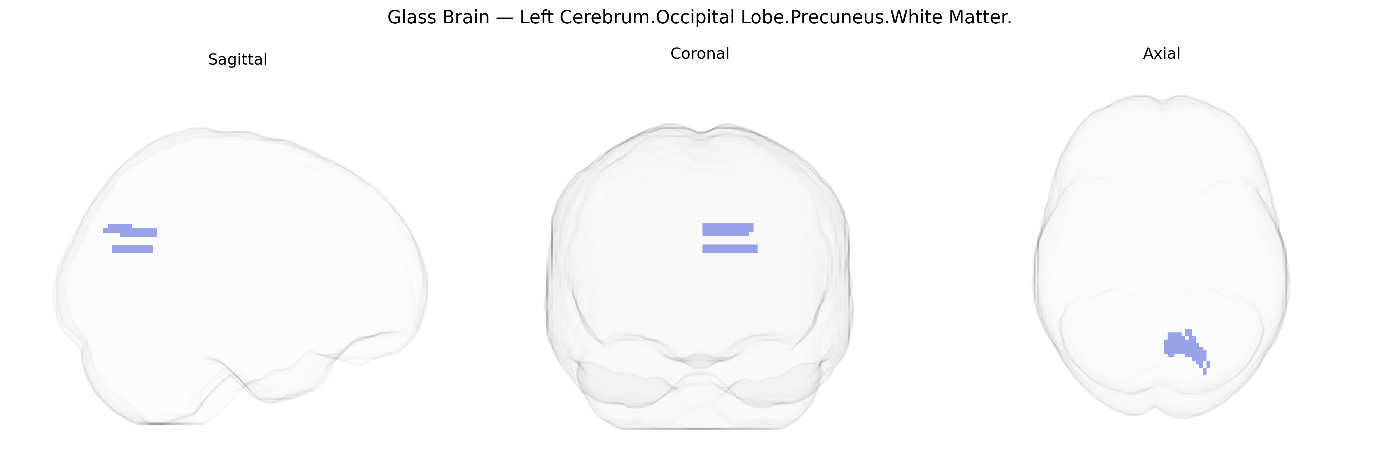 Triplanar Ghost Brain