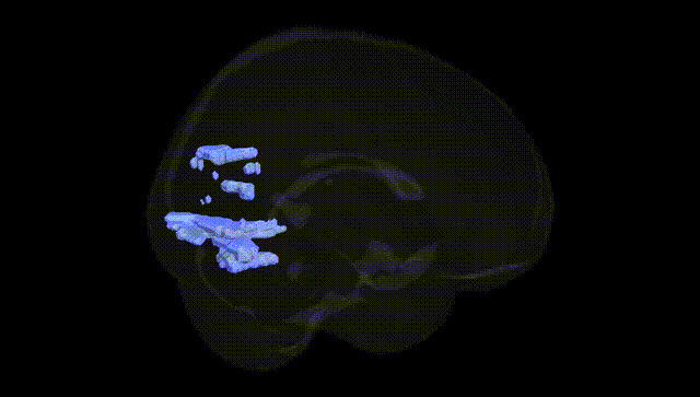 Full Brain Black