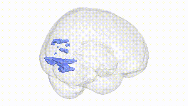 Full Brain White