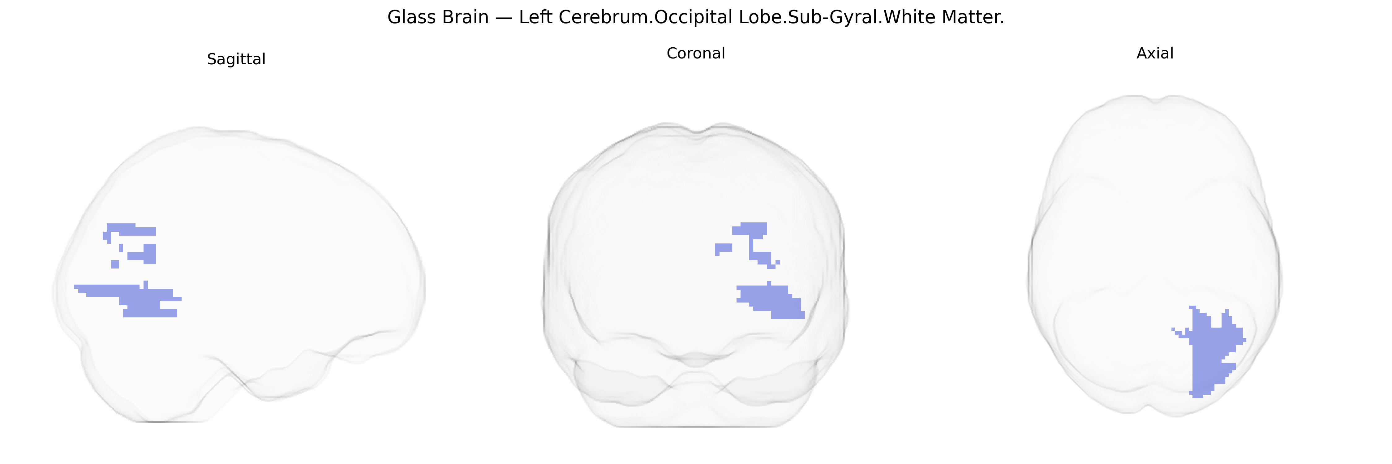 Triplanar Ghost Brain