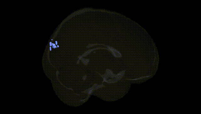 Full Brain Black