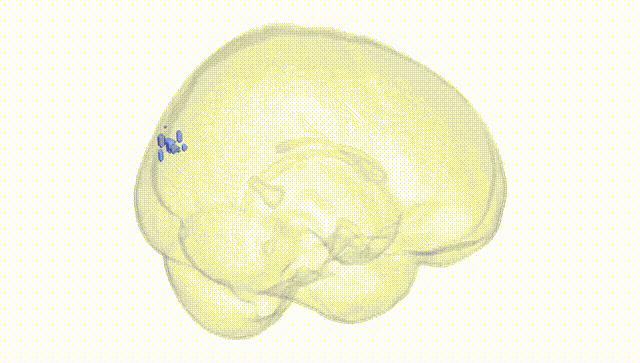 Full Brain White
