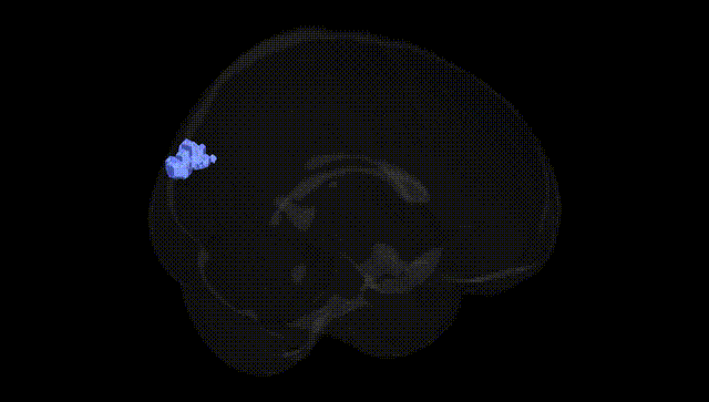 Full Brain Black