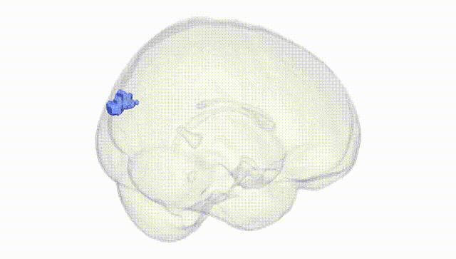 Full Brain White