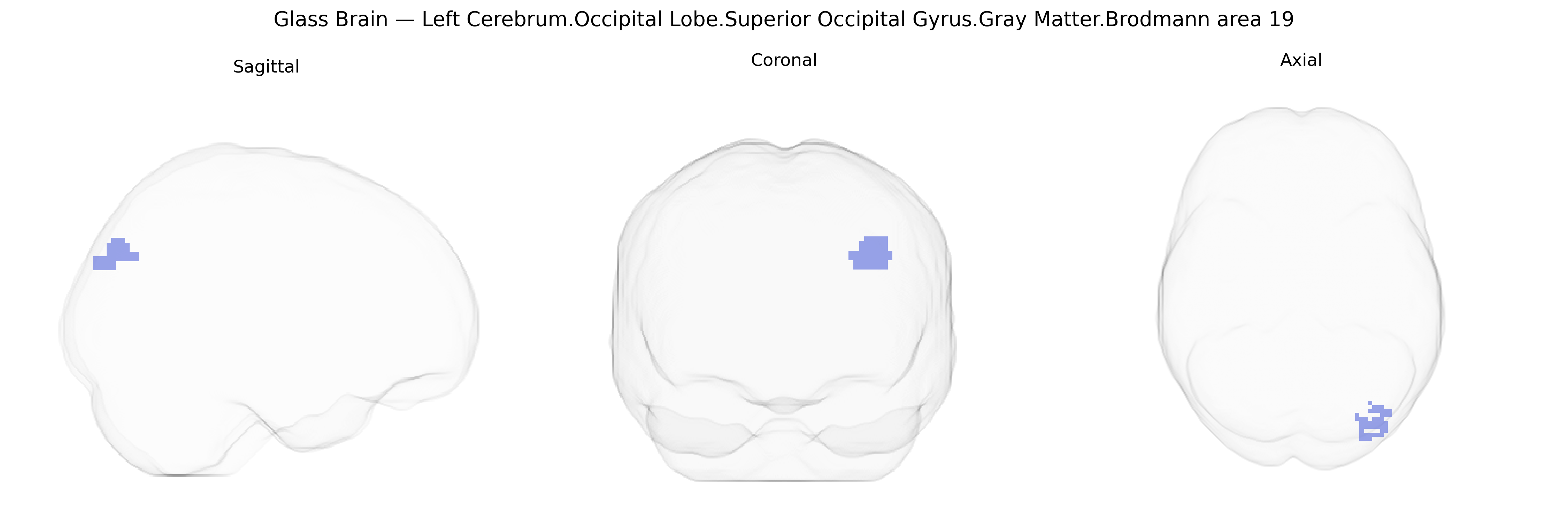 Triplanar Ghost Brain